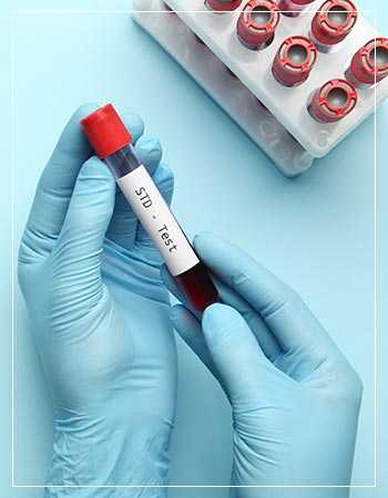 STD Testing Near Me in Miami, FL STD Testing Near Me in Miami, FL